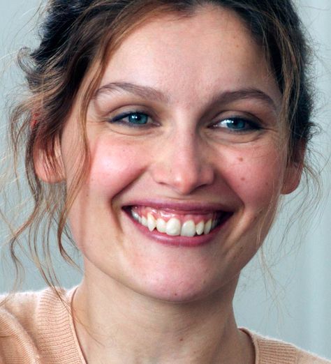 Crooked Face, French Portrait, Crooked Teeth, Perfect Teeth, Laetitia Casta, Gold Teeth, Celebrity Beauty, Beautiful Curves, Christina Aguilera