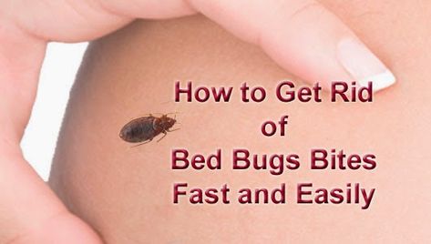 How to Get Rid of Bed Bugs Bites Fast and Easily | Arbkan Bed Bug Bites Remedies, Bed Bugs Bites, Bed Bug Bites Pictures, Essential Oils Bug Bites, Bed Bug Remedies, Mosquito Bite Itch, Remedies For Mosquito Bites, Bug Bites Remedies, Bug Bite Relief