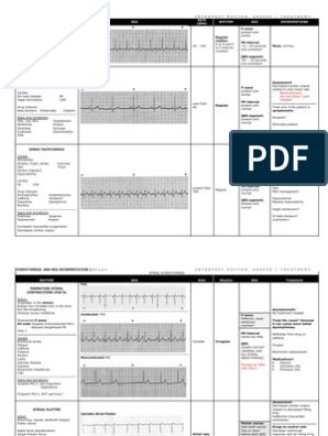 Cardiac Drugs | Cardiology | Heart Cardiac Electrophysiology, Ekg Interpretation, Normal Sinus Rhythm, Ecg Interpretation, Pr Interval, Cardiac Rhythms, Intracranial Pressure, Nursing Cheat, Lab Values