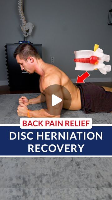 Dr. Grant Elliott on Instagram: "💥 Disc Herniation Recovery ❌ Have you been lifting and felt a POP in your low back? Now the next day you can barely stand up straight Or you find yourself actually crawling to the bathroom? This is a common disc herniation scenario our clients come to us with every week! Next thing you know you get an MRI, are referred for injections, and now you are looking at surgery…. This can totally be avoided! 🔑 This does resemble a classic disc herniation scenario, but you don’t have to follow the wrong path like most do. Instead, if you follow our approach you have a 97% chance of recovering WITHOUT SURGERY We talk to around 200 online clients a week with disc issues, and this process is a quick formula we created that will help most begin the recovery proc Workouts With Herniated Discs, L5 S1 Disc Herniation, Slipped Disk Relief, Herniated Disk In Lower Back Relief, Herniated Disk In Lower Back, Disc Herniation, Stand Up Straight, Lumbar Disc, Back Relief