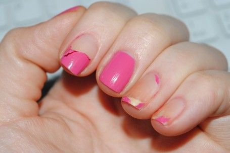 Tips to Prevent Peeling and Cracking of Nail Polish 2020 Flaky Nails, Nail Falling Off, Peeling Nails, Emerald Nails, Nail Problems, Spring Acrylic Nails, Gel Acrylic Nails, Gelish Nails, Popular Nail Designs