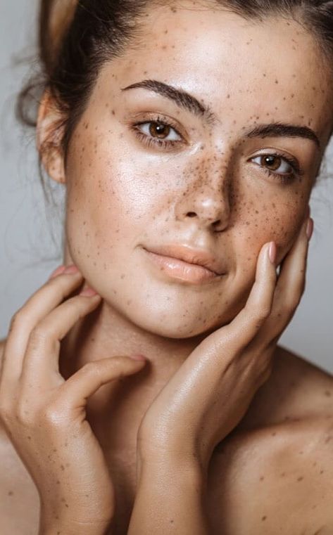 Woman With Freckles, Women With Freckles, Beautiful Freckles, Skin Tightening Face, Freckles Girl, Forehead Wrinkles, Clear Skin Tips, Brunette Woman, Celebrity Makeup Artist