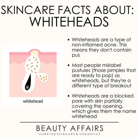 Knowing how to get rid of whiteheads starts with knowing what is a Whitehead in the first place. What many people think a Whitehead is, is actually incorrect! Read our skincare facts about what a Whitehead is and how to clear this type of acne at Beauty Affairs Australia. Esthetics Notes, Beauty Affairs, Ceo Inspiration, Skin Knowledge, Dry Skin Diy, Skincare Facts, Licensed Esthetician, Pimples Under The Skin, Skin Facts