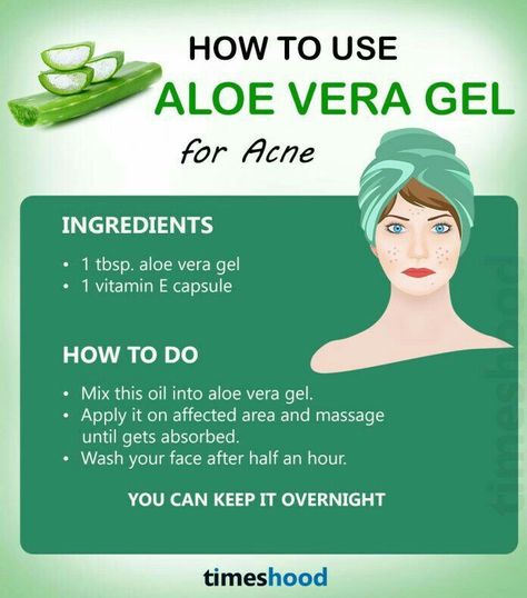 Aloe Vera Gel For Face, Remedies For Pimples, Aloe Vera Hair, Acne Hacks, Chest Acne, Get Rid Of Pimples, Rid Of Pimples, Forehead Acne, Aloe Vera Benefits