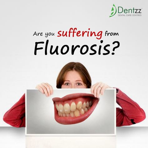 Suffering from Flurosis? Dentzz will provide ideal solution for this Dental Campaign, Dental Puns, Dental Fluorosis, Dentist Branding, Dental Posts, Dental Posters, Dental Facts, Dental Marketing, Dental Art