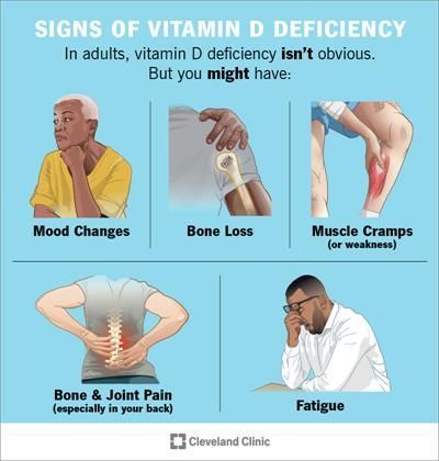 Vitamin D Deficiency Symptoms, Vitamin D Benefits, Iv Solutions, Vitamin D Foods, Deficiency Symptoms, Vitamin Deficiency, Vitamin D Deficiency, Magnesium Deficiency, Muscle Weakness