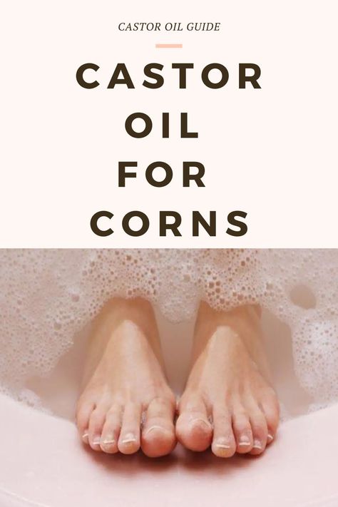 Get Rid Of Corns On Feet Fast, Foot Corn Removal Remedies, Corn Removal On Toes, Castor Oil Bone Spur, Castor Oil Pack Benefits, Get Rid Of Corns, Corn Removal, Castor Oil Uses, Nail Remedies