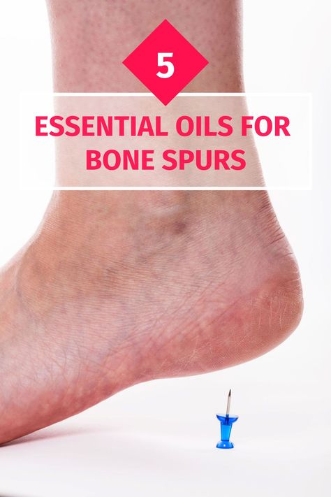 Want to know about the symptoms, causes and prevention of bone spurs. Read on as we explore the best essential oils and blends to deal with the sharp pain associated with bone spurs. Bone Spur Remedies Essential Oils, Bone Spur Remedies, Nerve Pain Remedies, Castrol Oil, Shoulder Bones, Neck Bones, Essential Oil Remedy, Oil Remedies, Essential Oil Benefits