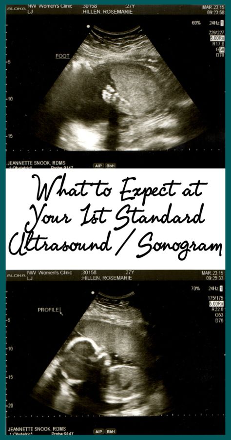 What to Expect at Your 1st Standard Ultrasound / Sonogram: A week ago, we had our first sonogram. For first-time mothers wondering what your first standard sonogram / ultrasound will be like, here’s how ours went.