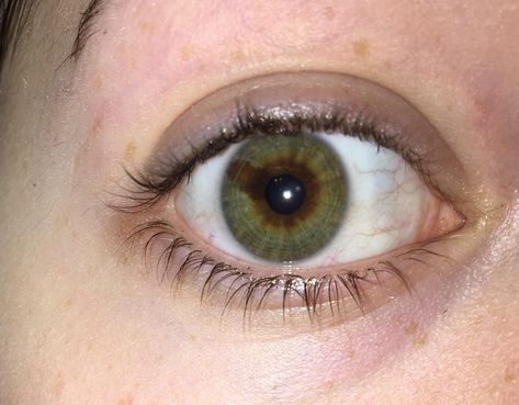 Sectoral Heterochromia Green And Brown, Hetrochormia Eyes Brown And Green, Green Brown Heterochromia, Green And Brown Heterochromia, Sectoral Heterochromia Green, Heterochromia Eyes Brown And Green, Baggy Eyes Aesthetic, Heterochromia Eyes Aesthetic, Green Eyes Heterochromia