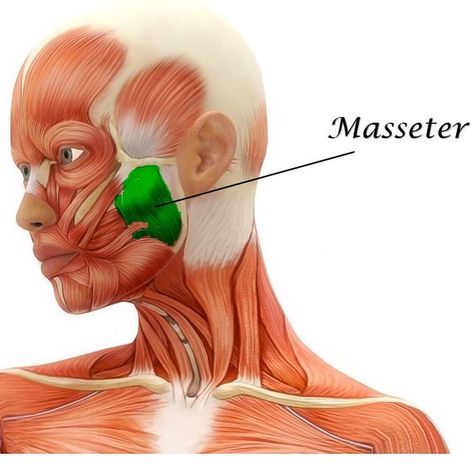 Update from my gorgeous patient! Jawline/face slimming with Botox injections into the masseter muscles 💉💁🏻‍♀️ —- Swipe to see exactly where… Muscles Of The Head, Supraspinatus Muscle, Infraspinatus Muscle, Masseter Muscle, Rectus Abdominis Muscle, Excessive Underarm Sweating, Sternocleidomastoid Muscle, Thoracic Cavity, Head Muscles