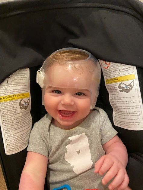 Such a happy guy!!  Cranial helmet. #onehelmetguarantee #chicagopediatricorthotics Cranial Helmet, Happy Guy, Pediatrics, Baby Face