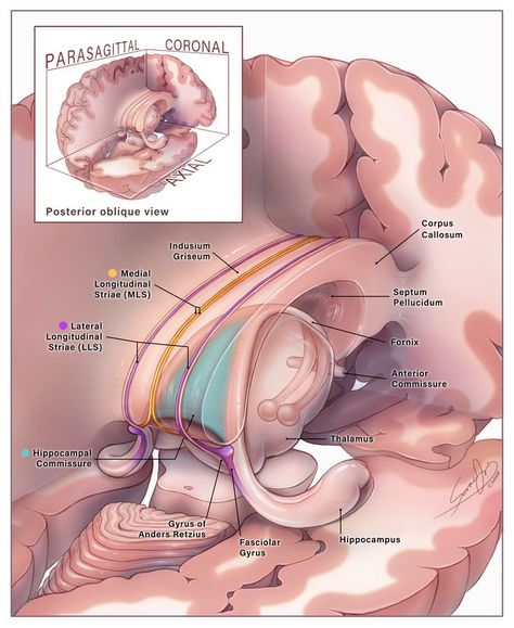 Mri Scans Aesthetic, Corpus Callosum, Bacillus Subtilis, Studying Medicine, Medical School Life, Medicine Notes, Basic Anatomy And Physiology, Medical Videos, Medical Student Study