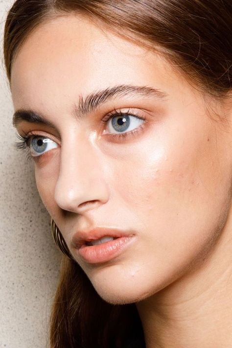 11 Easy Ways to Brighten Dull Skin How To Fade Scars, Skincare Products To Use, Treating Cystic Acne, Habits To Change, Different Types Of Acne, Hyaluronic Acid Moisturizer, How To Fade, Skincare Habits, Skincare Essentials