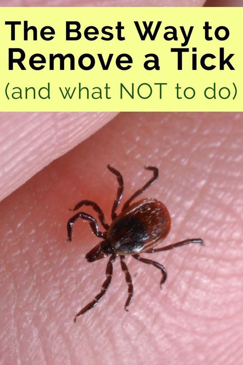 How To Remove A Tick From A Human, Remove Ticks From Humans, Ticks On Humans, Tick Repellant, Wood Tick, Tick Bite, Tick Removal, Tick Repellent, Teaching Manners