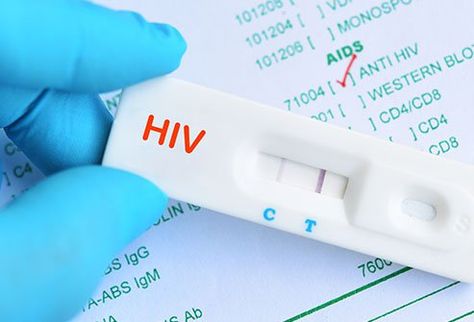 AIDS Rapid Test Kit Market Future Demand Analysis, Features Industry sizes, Key Objective Forcast upto 2020-2025 Hiv Test, Living With Hiv, Hiv Positive, International Development, Performance Reviews, Trend Analysis, Online Journal, Partner Work, Swot Analysis