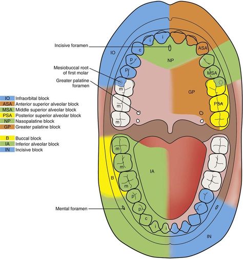 DentalEdge Youtube anesthesia videos-they're awesome! Dental Anesthesia, Dental Assistant Study Guide, Dental Hygiene Humor, Dental Terminology, Nerve Anatomy, Local Anesthesia, Dental Assistant Study, Dental Hygiene Student, Dental Hygiene School