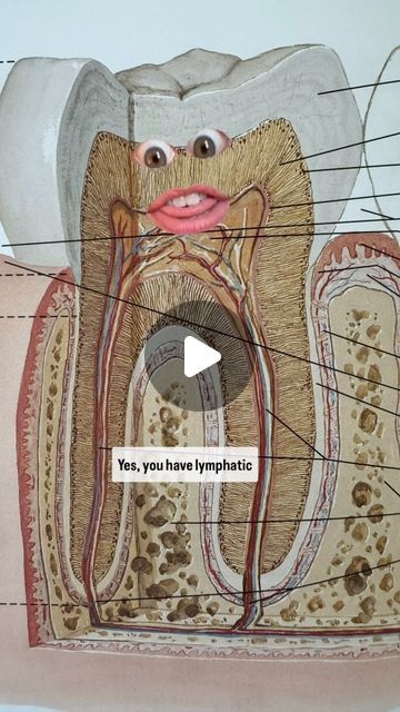 Leah Levitan | Lymph Literacy Advocate on Instagram: "Nearly 1/3 of lymph nodes in the body are located in the head and neck, and within the dentin (matrix of collagen fibers, aka: connective tissue) of each individual tooth we find blood, lymph, and nerves. 

The lymphatic system in our teeth:

🦷 Protects against infections in the mouth

🦷 Helps maintain bone density and the stability of the teeth

🦷 Removes excess fluid, proteins, and cellular debris to maintain a healthy environment

🦷 Supports the healing process and prevents chronic inflammation

Lymph from the gums, connective tissue, bone socket and teeth drains into the submandibular and submental lymph nodes under the jaw. Swollen lymph nodes there? Could be tooth related. 

👀 Look to the site of an old crown, root canal, or Swollen Lymph Node In Neck, Lymph Nodes Location, Collagen Fibers, Big Six, Connective Tissue, Lymph Nodes, Root Canal, Bone Density, Chronic Inflammation