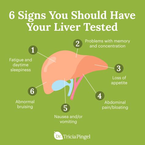 Have you noticed noticed changes in your health recently but can't quite pinpoint the cause? If so, it may be time to get your liver tested. Sometimes the signs of liver damage can be confused with other conditions, and because the liver is responsible for filtering out toxins, it's a critical organ for optimal health. Take a look at some off the signs of liver damage above, and then head over to drpingel.com to learn more about how to get your liver tested and what to do Signs Of Liver Damage, Low Thyroid Remedies, Quadrants Of The Abdomen, Liver Cleanse Juice, Thyroid Remedies, Lung Detox, Liver Damage, Kidney Detox, Low Thyroid