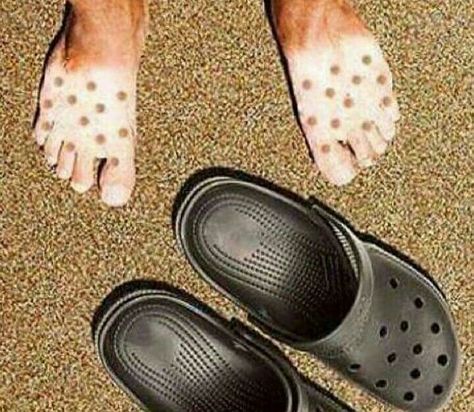 That's why i hate crocs Strange Photos, 웃긴 사진, Memes Humor, Funny People, Bones Funny, Funny Photos, Funny Cute, Funny Texts, Funny Images