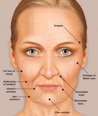 The face of a person is the most distinguished part of the human body. Naturally, this is the part that everyone first sees in a human being, so every person wants his face to be in good condition. Chin Wrinkles, Facial Aging, Skin Anatomy, Facial Anatomy, Face Anatomy, Facial Fillers, Cosmetic Injectables, Face Mapping, Face Change