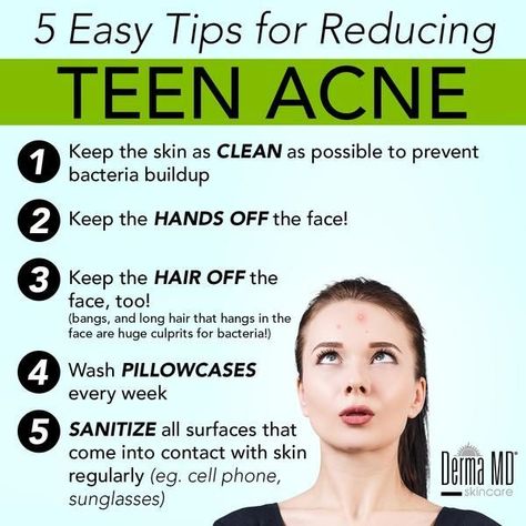 Skin Care Solutions For Teenagers Acne Scar Remedies, Teenage Acne, Forehead Acne, Skin Care Guide, Natural Face Skin Care, Acne Skincare Routine, Severe Acne, Types Of Acne, Diy Skin Care Recipes