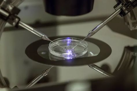 Future of IVF? Scientists work to create babies without egg, sperm Ivf Procedure, Sperm Donor, Genetic Diseases, Ivf Cycle, In Vitro Fertilization, In Vitro, Genetic Testing, High Court, Parents Baby