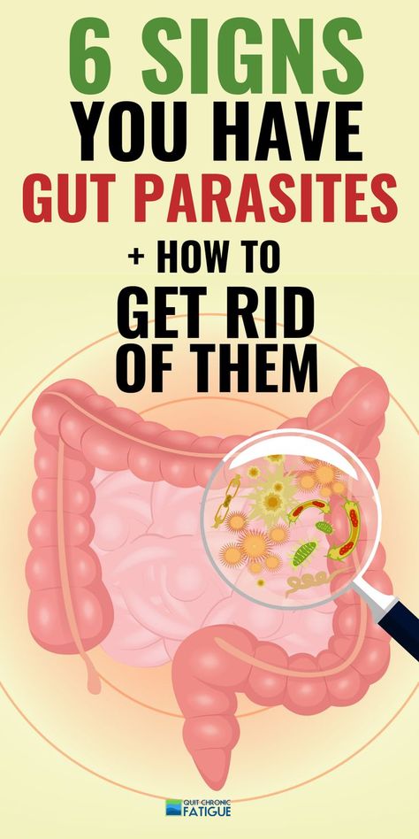 Stomach parasites symptoms - are they causing your fatigue or other health issues? #stoamchparasitessymptoms #stomachparasites #stomachparasitecleanse Parasites Symptoms, Cleaning Your Colon, Intestinal Parasites, Parasite Cleanse, Stomach Problems, Home Health Remedies, Colon Cleanse, Natural Health Remedies, Chronic Fatigue