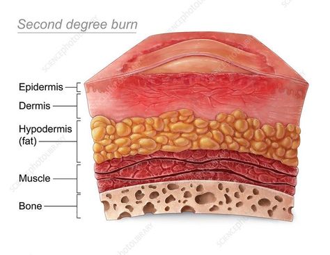 Degree Burns, Art Photography Portrait, Science Photos, Photography Portrait, Photo Library, Anatomy, Nursing, Art Photography, Education