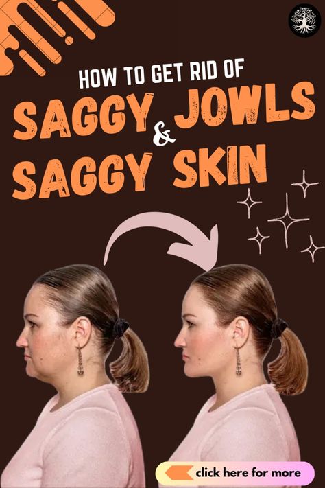 Reclaim your youthful allure with our step-by-step guide on banishing saggy jowls and skin for a more splendid appearance. How do you tighten loose skin on jowls? How can I tighten my jowls without surgery? How can I tighten my jaw skin? what to do about sagging jowls. what causes jowls. what are jowls. treatment for jowls. tighten jowls. skin under chin loose. saggy jowls botox. saggy jowls. saggy chin skin. saggy cheeks before and after. sagging jowls botox. sagging jowls before and after. sagging jowls. How To Prevent Sagging Jowls, Makeup For Jowls, Sagging Face Remedies, Contouring For Jowls, Tighten Jowls Sagging Skin, How To Get Rid Of Jowls Naturally, Saggy Cheeks Face Exercises, Get Rid Of Jowls The Face, Face Yoga For Jowls