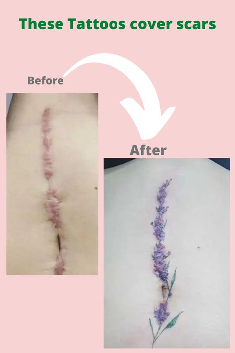 #ScarCoverupTattoos #TattooTransformation #ScarTattooArt #InkOverScars #HealingInk #BodyArtHealing #ScarCamouflage #TattooHealingJourney #InkedCoverup #ScarArtistry #TattooedScars #CreativeCoverups #EmpoweringInk #ScarToArt #InkTherapy Straight Scar Tattoo, Surgery Tattoo Cover Up, Knee Tattoo To Cover Scar, Tattoo To Cover Ankle Scar, Tattoo Over Knee Scar, Spine Tattoos To Cover Scar, Knee Surgery Tattoo Cover Up, Ankle Tattoo Scar Cover, Knee Replacement Scar Tattoo