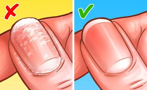 How to Remove Gel Nail Polish at Home How To Fix Nails After Gel Polish, How To Remove Gel Nail Polish, How To Remove Gel Polish At Home, Remove Gel Nails At Home, Liquid Gel Nails, Gel Nail Polish At Home, Remove Gel Nail Polish, Nail Glue Remover, Gel Nail Polish Remover