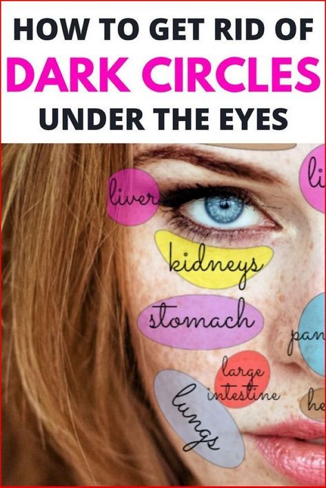 Remove The Dark Circles And Bags Under The Eyes With This Natural And Easy Treatments!!! Remove Dark Eye Circles, Undereye Bags Remedy, Eye Bag Remedies, Dark Circle Remedies, Remove Eye Bags, Dark Circles Under The Eyes, Herbal Therapy, Dark Eye Circles, Face Mapping