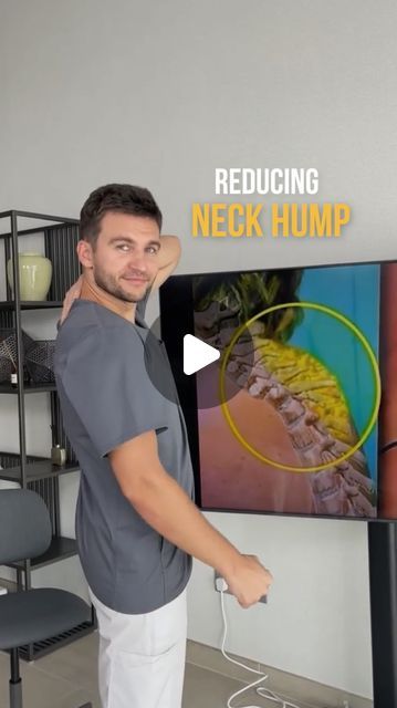 Stretches To Help Neck Hump, Fix Neck Hump Exercises, Exercise For Hump Neck, Dowagers Neck Exercises, Stretches To Fix Neck Hump, How To Fix Posture Neck Hump, Dowager's Hump, Neck Hump, Neck Exercises