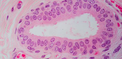 found in the skin in the lining of sweat glands.  this tissue is good for secretion and select. you can identify these by looking for 2 rows of cells that look mostly symmetric and cubed Epithelial Tissue, Histology Slides, Sweat Gland, After Effect Tutorial, Med Student, Anatomy, Slides, Wordpress, That Look