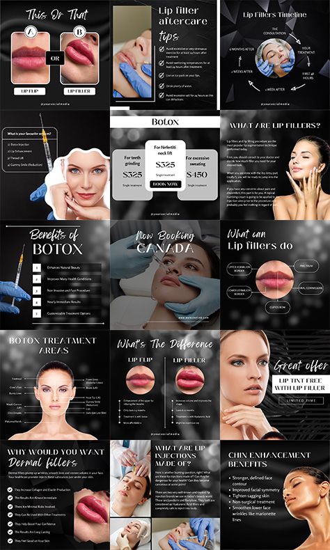 READY TO POST LUXURY NURSE INJECTOR INSTAGRAM TEMPLATES 🔥 Collection of 70 Instagram Post 🔥 Instagram Posts and Stories Templates are a perfect way to engage with your audience 🔥 Aestethic, stylish, minimalistic fitness instagram templates. Will help to make your profile more recognisable. Medspa Instagram Post, Aesthetic Injector Instagram Feed, Botox Social Media, Aesthetic Injector Instagram, Nurse Injector Instagram, Botox Ig Post, Instagram Grid Design, Instagram Business Account, Social Media Branding Design