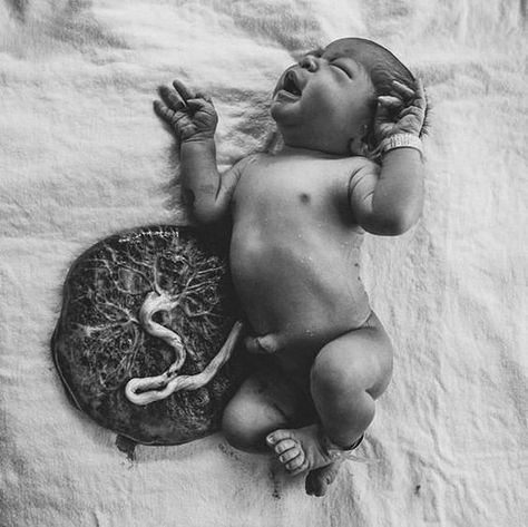 Birth Photoshoot, Birth Photography Hospital, Doula Art, Home Birth Photography, Informed Consent, Birth Photos, Hospital Birth, Hospital Photos, Birth Doula