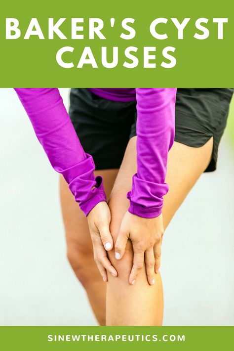 Causes of a Baker's Cyst Bursitis Knee, Jumpers Knee, Patellofemoral Pain Syndrome, Swollen Knee, Runners Knee, Stem Cell Therapy, Knee Exercises, Knee Pain Relief, Massage Techniques