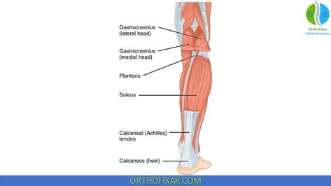 Gastrocnemius Muscle Medical Terminology Games, Soleus Muscle, Gastrocnemius Muscle, Muscle Anatomy, Lower Limb, Orthopedic Surgery, Medical Terminology, Free Medical, Calf Muscles