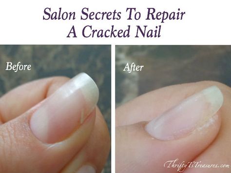 Shared from a nail tech, these salon secrets to repair a cracked nail are tried and true tips and techniques that you can use at home. There’s no need to head to the salon because you can DIY! Fix Cracked Nail, Fix Broken Nail, Repair Broken Nail, Cracked Nails, Nail Tek, No Chip Nails, Broken Nails, Nail Repair, Manicure Tips