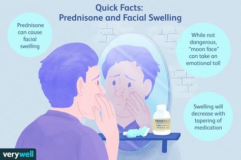 Moon Face: Facial Swelling Caused by Prednisone Face Swelling Causes, Moon Face Swelling, Prednisone Moon Face, Face Swelling, Prednisone Side Effects, Facial Swelling, Effective Management, Chest Congestion, School Info