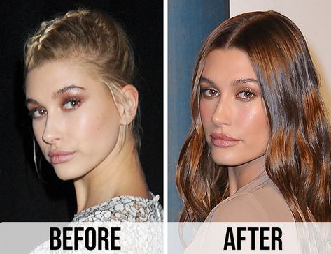 Fans Are Calling Out Hailey Bieber's Before And After Images In Light Of Kanye West's 'Nose Job' Claims | SHEfinds Hailey Bieber Nose Job, Hailey Bieber Before And After, Nose Job, Hailey Bieber, Kanye West, Fan, Hair