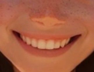 Perfect Teeth Aesthetic Korean, Sharp Canine Teeth Human Aesthetic, Teeth Claims For Dr Sharp, Smile Claim For Dr, Sharp Canines Human, Pretty Teeth Smile, Teeth Claims For Dr, Teeth Claim, Perfect Smile Aesthetic