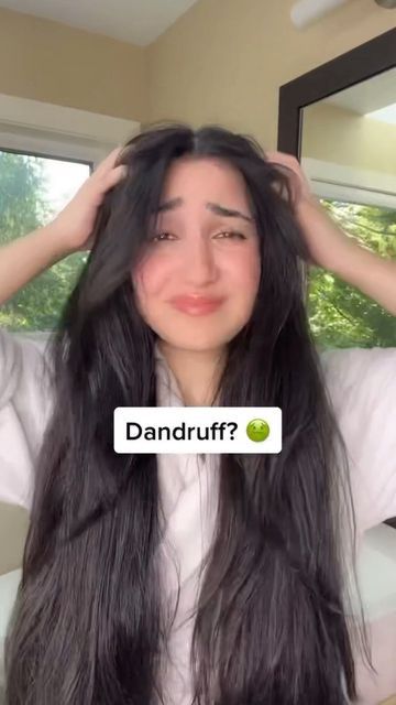 Camelia Katoozian on Instagram: "DIY remedy for dandruff, itchiness, and a dry scalp! 💆🏻‍♀️ This remedy will help get rid of dandruff and will encourage hair growth at the same time! It also strengthens the hair and adds shine ✨ 1️⃣ 1 part apple cider vinegar + 1 part water + 10 drops of tea tree oil (optional) 2️⃣ Pour ingredients into a spray bottle 3️⃣ Spray all over scalp and hair and continue to massage scalp 4️⃣ Leave this on for an hour then wash hair normally with shampoo 5️⃣ Enjoy t Essential Oils For Dandruff, Remedy For Dandruff, How To Remove Dandruff, Severe Dandruff, Dandruff Causes, Dandruff Solutions, Oils For Dandruff, Dandruff Flakes, Rid Of Dandruff