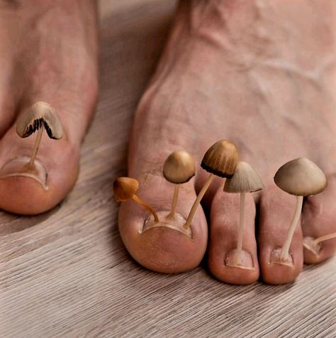 Weird Images, Toenail Fungus, Nails Only, Nail Fungus, Homemade Soup, Health Information, Health Facts, Body Health, Health And Wellbeing