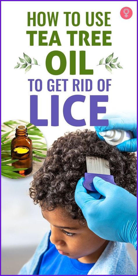 Self-love is the best kind of love. #BeautyTips #skincare #haircare #BeautySecrets Tea Tree Oil For Lice, Lice Remedies, Hair Lice, Head Louse, Hair Growth Supplement, Hair Growth Serum, Environmental Damage, Hair Back, Hair Breakage