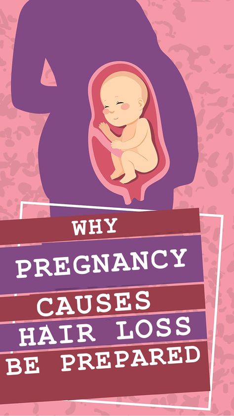 Find out why women lose so much hair after giving birth #earlybirth #pregnancysymtoms #hairloss Hair Is Falling Out, Postpartum Symptoms, Pregnancy Loss, After Giving Birth, Pregnancy Symptoms, Giving Birth, After Pregnancy, Be Prepared, New Mothers