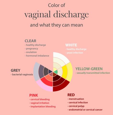 White Discharge During Pregnancy, Spotting During Pregnancy, Urine Color, Fertilization Process, Neon Prom Dresses, Pimples Remedies, Shingle Colors, Early Pregnancy, Fashion Terms