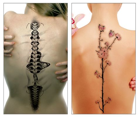 Tattoos of spinal bones and Cherry Blossom tree Spinal Scar Tattoo, Spinal Cord Anatomy Tattoo, Spinal Fusion Tattoo, Spinal Surgery Tattoo, Spine Tattoo Of Spine Bones, Cherry Blossom Tree Tattoo, Blossom Tree Tattoo, Best Tattoos For Women, Foot Tattoos For Women