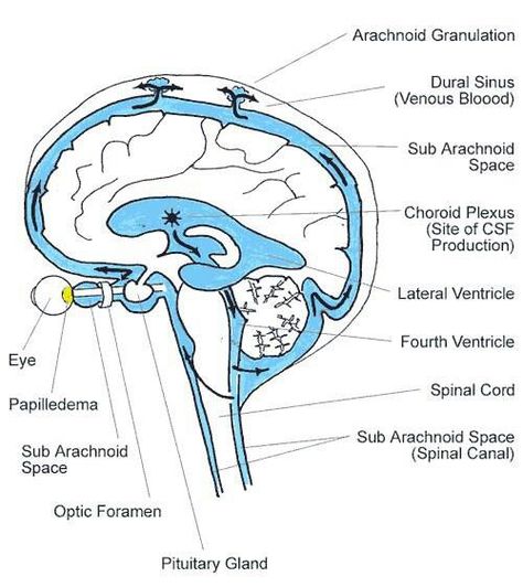 CSF Choroid Plexus, Intercranial Hypertension, Iih Awareness, Nursing Knowledge, Intracranial Pressure, Spinal Fluid, Spoon Theory, Chiari Malformation, Cerebrospinal Fluid